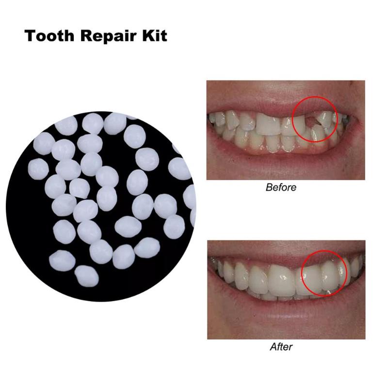 10g/100g Denture Solid Glue Dental Restoration Temporary Tooth Repair Kit Oral Care Tool